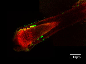 Isolated, growing human hair follicle, showing mitochondrial membrane potential (red) and reactive oxygen species (green).