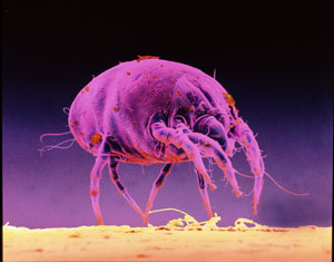 People living in countries with similar climates in the tropical belt (Singapore, Malaysia, Indonesia and others) showed similar evidence of exposure to two species of dust mites, Dermatophagoides pteronyssinus (above) and Blomia tropicalis.