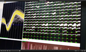 Electrical signals in the brain’s short-term memory center, located in the prefrontal cortex, morph when faced with distracting stimuli.