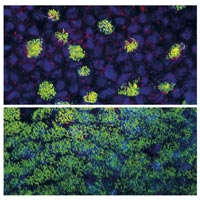 Clean sweep for lung cells - A*STAR Research